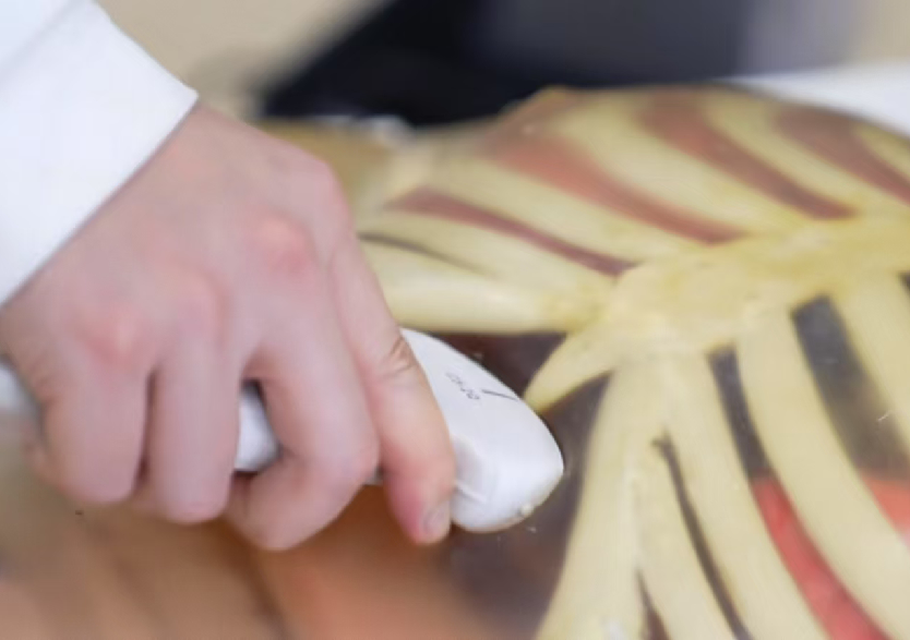 綜合超聲檢查平臺(tái)3.0