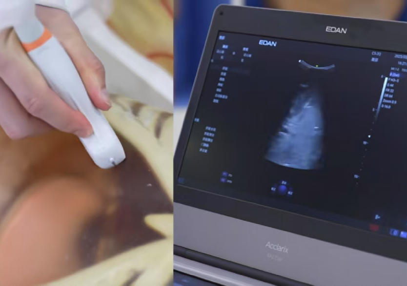 綜合超聲檢查平臺(tái)3.0